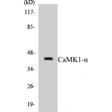 CaMK1-alpha Colorimetric Cell-Based ELISA Kit
