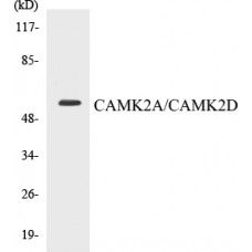 CAMK2A/CAMK2D Colorimetric Cell-Based ELISA Kit