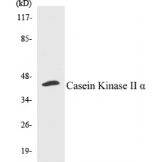 Casein Kinase II alpha Colorimetric Cell-Based ELISA Kit
