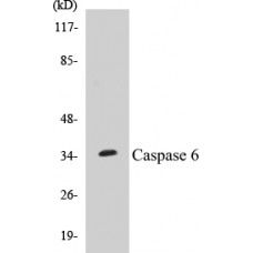 Caspase 6 Colorimetric Cell-Based ELISA Kit