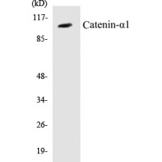 Catenin-alpha1 Colorimetric Cell-Based ELISA Kit