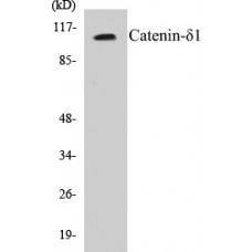 Catenin-delta1 Colorimetric Cell-Based ELISA Kit