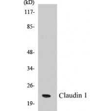 Claudin 1 Colorimetric Cell-Based ELISA Kit