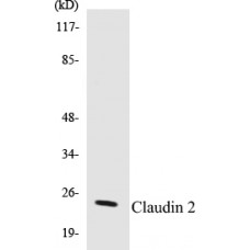 Claudin 2 Colorimetric Cell-Based ELISA Kit