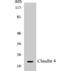 Claudin 4 Colorimetric Cell-Based ELISA Kit