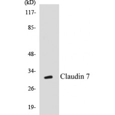 Claudin 7 Colorimetric Cell-Based ELISA Kit