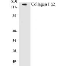 Collagen I alpha2 Colorimetric Cell-Based ELISA Kit
