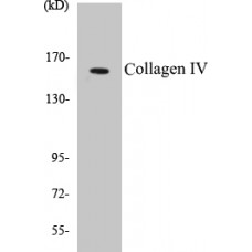 Collagen IV Colorimetric Cell-Based ELISA Kit