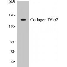 Collagen IV alpha2 Colorimetric Cell-Based ELISA Kit