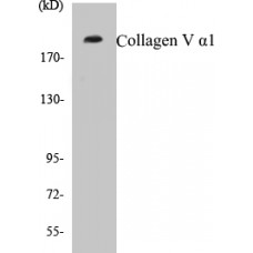 Collagen V alpha1 Colorimetric Cell-Based ELISA Kit