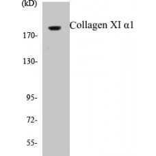 Collagen XI alpha1 Colorimetric Cell-Based ELISA Kit