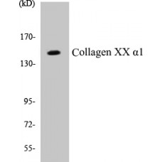 Collagen XX alpha1 Colorimetric Cell-Based ELISA Kit