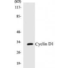 Cyclin D1 Colorimetric Cell-Based ELISA Kit