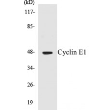 Cyclin E1 Colorimetric Cell-Based ELISA Kit
