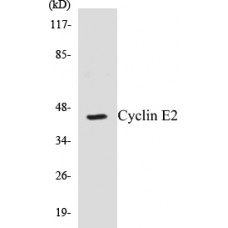Cyclin E2 Colorimetric Cell-Based ELISA Kit