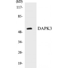 DAPK3 Colorimetric Cell-Based ELISA Kit