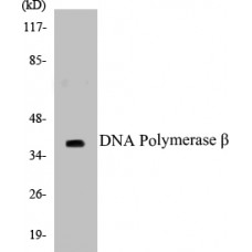 DNA Polymerase beta Colorimetric Cell-Based ELISA Kit
