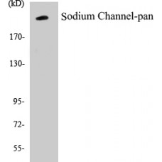 Sodium Channel-pan Colorimetric Cell-Based ELISA Kit