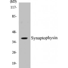 Synaptophysin Colorimetric Cell-Based ELISA Kit