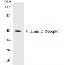 Vitamin D Receptor Colorimetric Cell-Based ELISA Kit