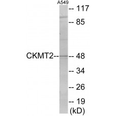 CKMT2 Colorimetric Cell-Based ELISA