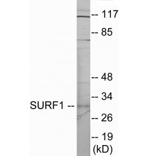 SURF1 Colorimetric Cell-Based ELISA