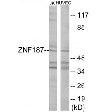 ZNF187 Colorimetric Cell-Based ELISA