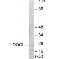 LDOC1L Colorimetric Cell-Based ELISA