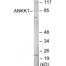 ANKK1 Colorimetric Cell-Based ELISA