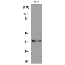 APE1 (Acetyl-Lys6) Antibody