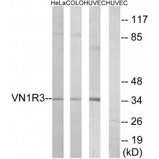 VN1R3 Antibody