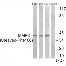 MMP3 (Cleaved-Phe100) Antibody