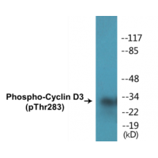 Cyclin D3 (Phospho-Thr283) Colorimetric Cell-Based ELISA Kit