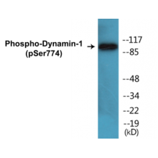 Dynamin-1 (Phospho-Ser774) Colorimetric Cell-Based ELISA Kit
