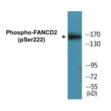 FANCD2 (Phospho-Ser222) Colorimetric Cell-Based ELISA Kit