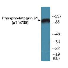 Integrin beta1 (Phospho-Thr788) Colorimetric Cell-Based ELISA Kit