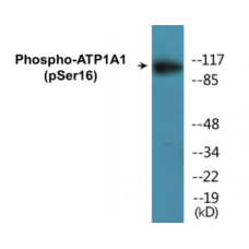 ATP1A1 (Phospho-Ser16) Colorimetric Cell-Based ELISA Kit