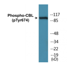 CBL (Phospho-Tyr674) Colorimetric Cell-Based ELISA Kit