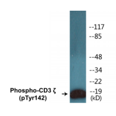 CD3 zeta (Phospho-Tyr142) Colorimetric Cell-Based ELISA Kit