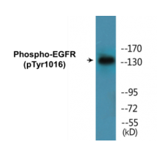 EGFR (Phospho-Tyr1016) Colorimetric Cell-Based ELISA Kit