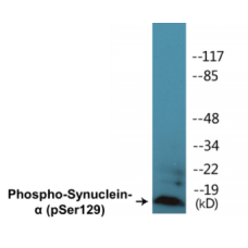 Synuclein-alpha (Phospho-Ser129) Colorimetric Cell-Based ELISA Kit