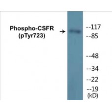 CSFR (Phospho-Tyr723) Colorimetric Cell-Based ELISA Kit