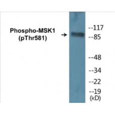 MSK1 (Phospho-Thr581) Colorimetric Cell-Based ELISA Kit