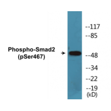 Smad2 (Phospho-Ser467) Colorimetric Cell-Based ELISA Kit