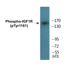 IGF1R (Phospho-Tyr1161) Colorimetric Cell-Based ELISA Kit