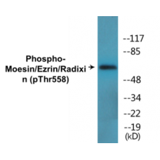 Moesin/Ezrin/Radixin (Phospho-Thr558) Colorimetric Cell-Based ELISA Kit