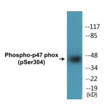 p47 phox (Phospho-Ser304) Colorimetric Cell-Based ELISA Kit