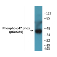 p47 phox (Phospho-Ser359) Colorimetric Cell-Based ELISA Kit