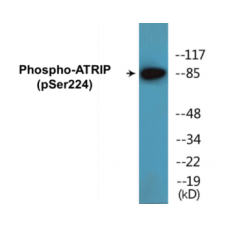ATRIP (Phospho-Ser224) Colorimetric Cell-Based ELISA Kit