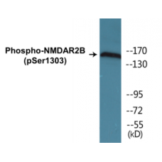 NMDAR2B (Phospho-Ser1303) Colorimetric Cell-Based ELISA Kit